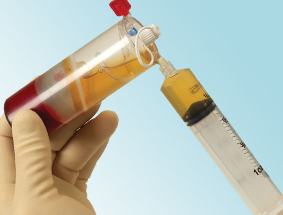 PLATELET RICH PLASMA (PRP)