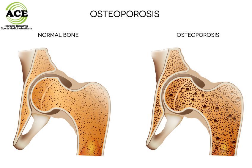 bone density